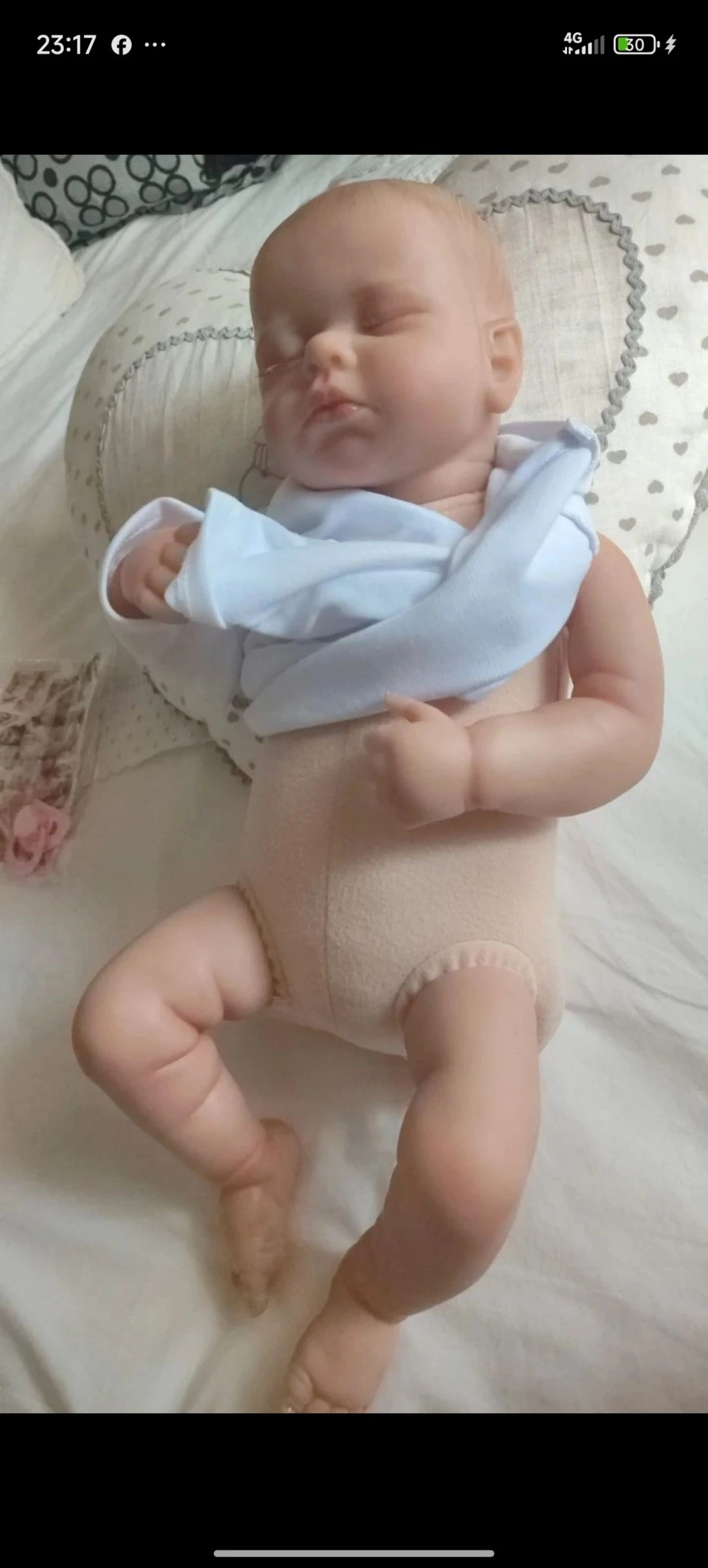 Bebe réanimé – photo 4